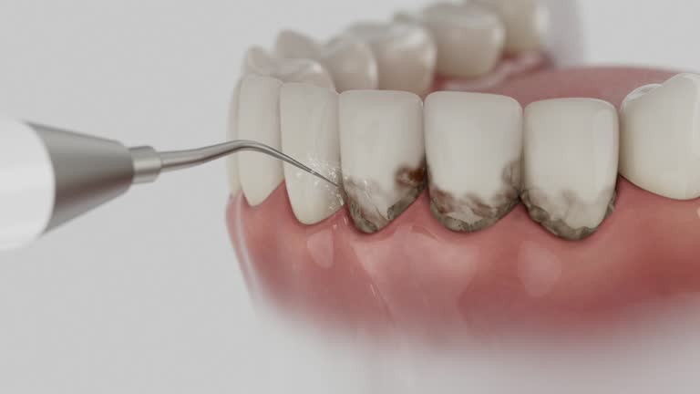 Reliable Dental Implants contractor in Vardaman, MS by Smile Center Dentistry